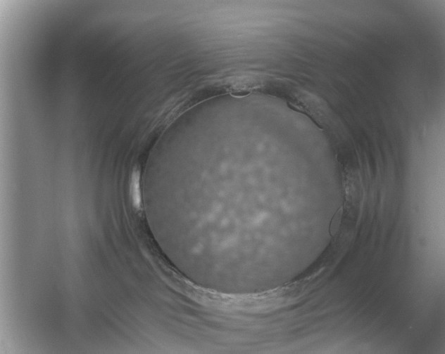 X0000058130046200510072017