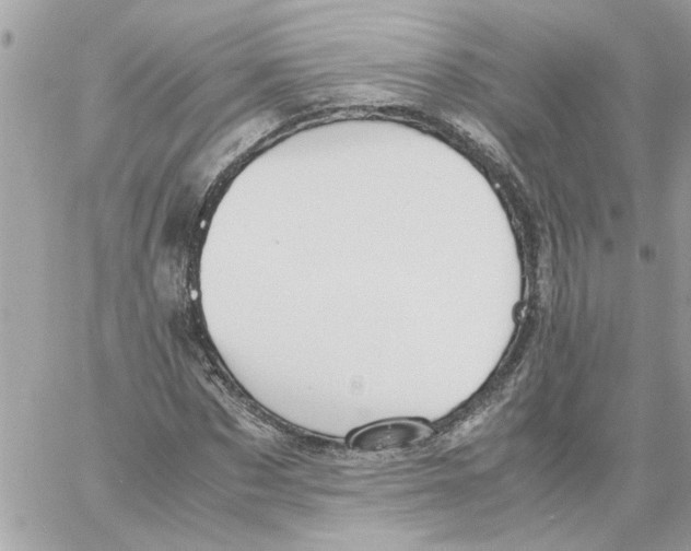 X0000058130873200510212043