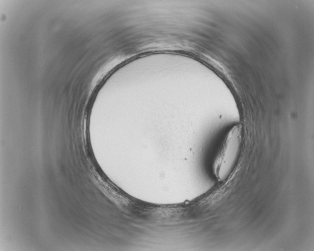 X0000058131179200510212038