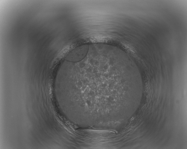 X0000058140687200509302019