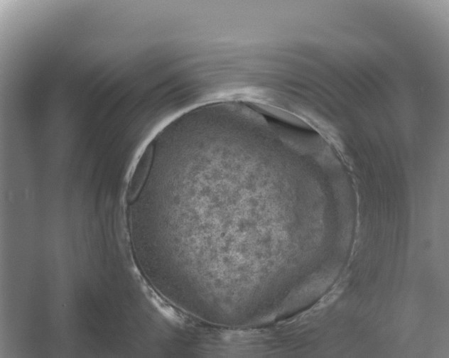 X0000058140816200509302017