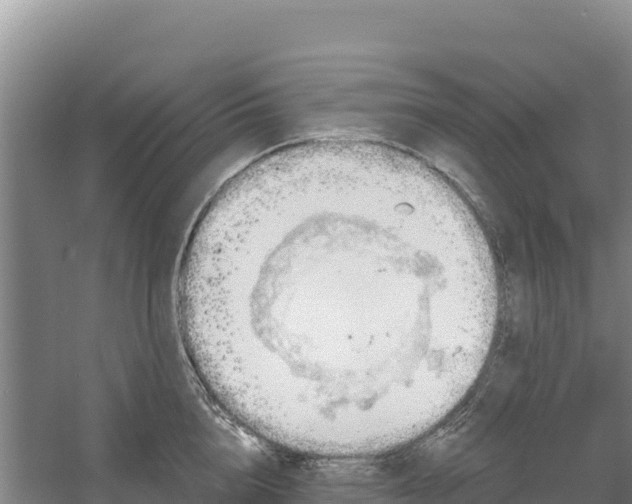 X0000058140856200509302017