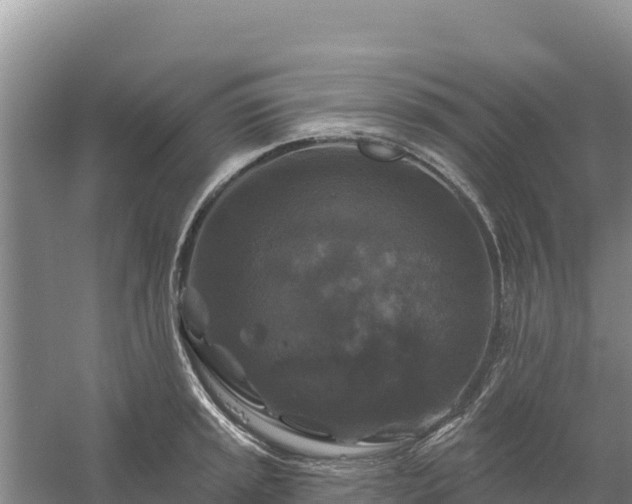 X0000058141045200509302014