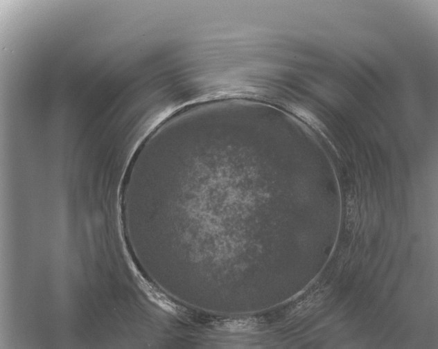 X0000058141047200509302014