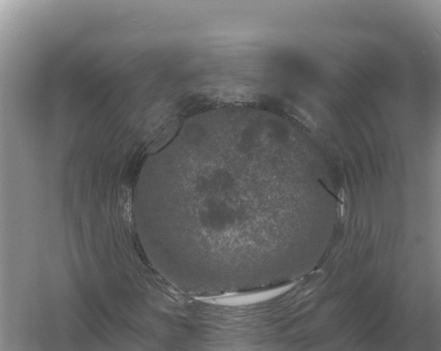 X0000058141251200509302010