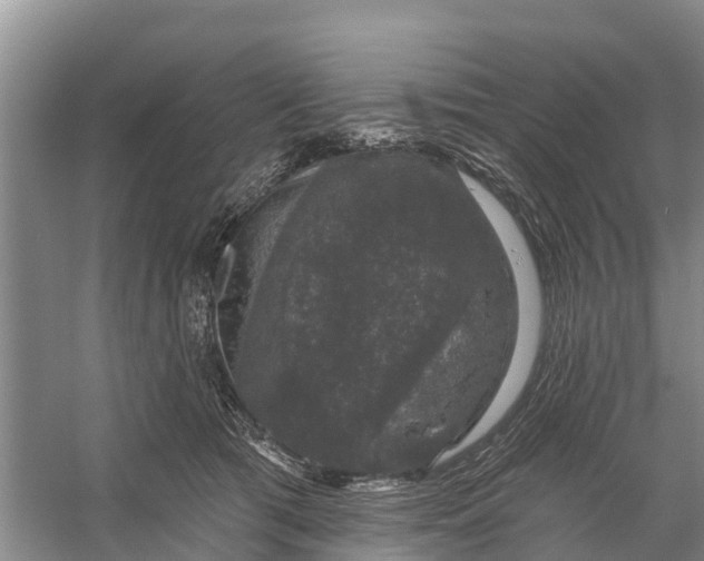 X0000058140417200510072036