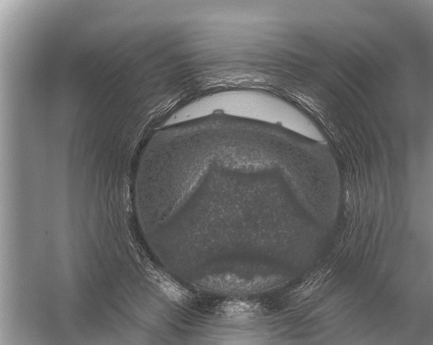 X0000058140453200510072036