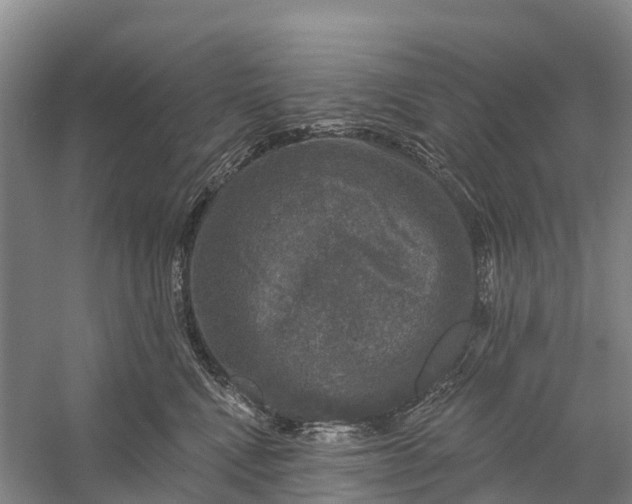 X0000058140472200510072036