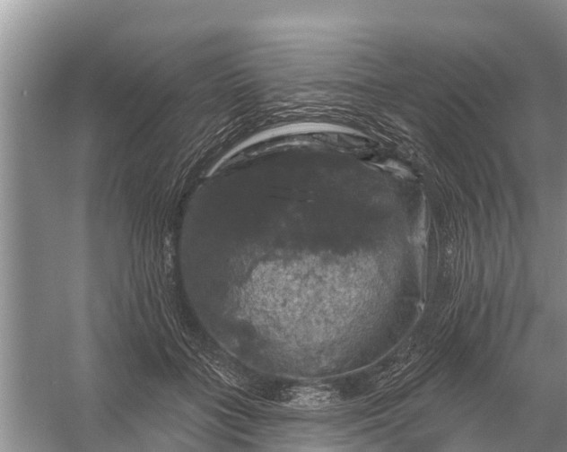 X0000058140555200510072034