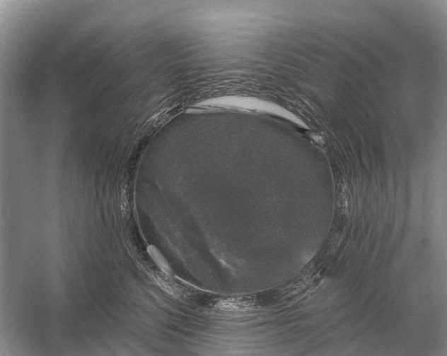 X0000058140568200510072034