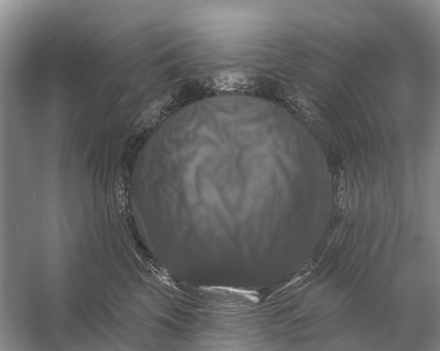 X0000058140569200510072034