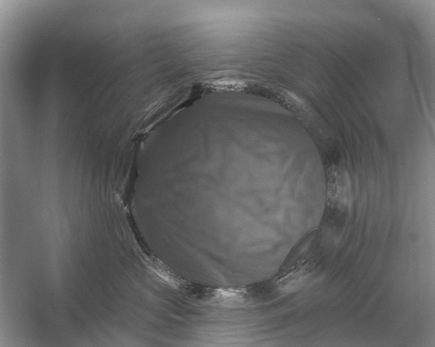 X0000058140573200510072034