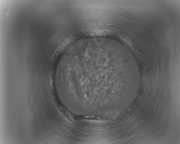 X0000058140687200510072032