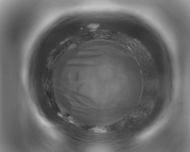 X0000058140765200510072031