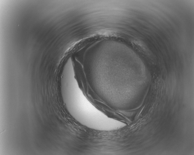 X0000058140776200510072030