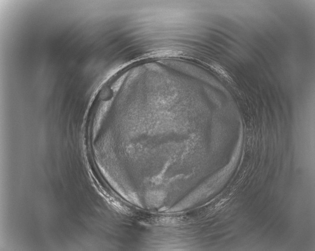 X0000058141086200510072025