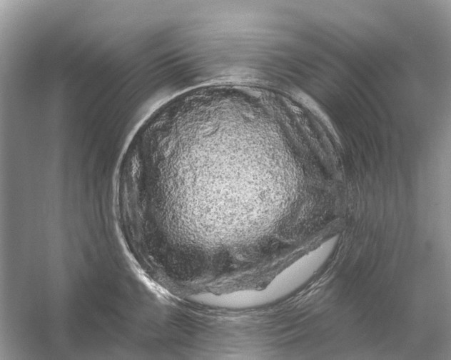 X0000058141099200510072025