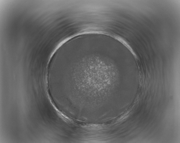 X0000058141101200510072025