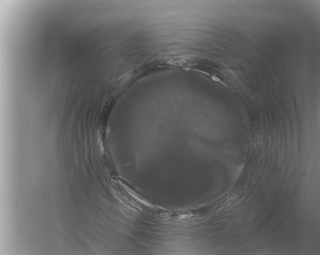 X0000058141106200510072024