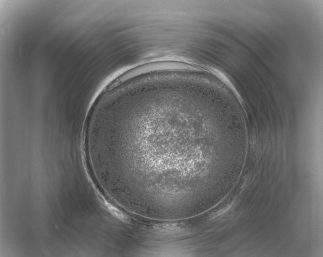 X0000058141149200510072025