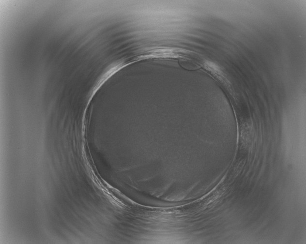 X0000058141378200510072020