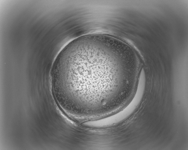 X0000058141476200510072018