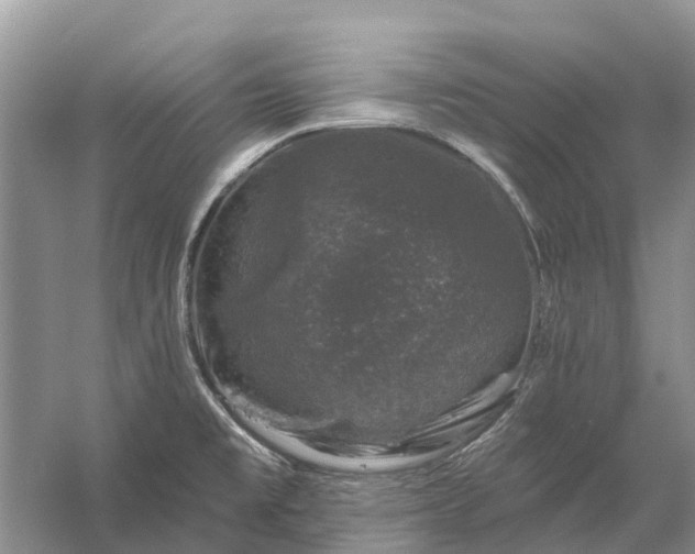 X0000058141477200510072018