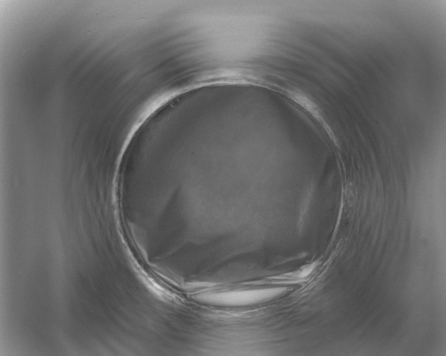 X0000058141482200510072018