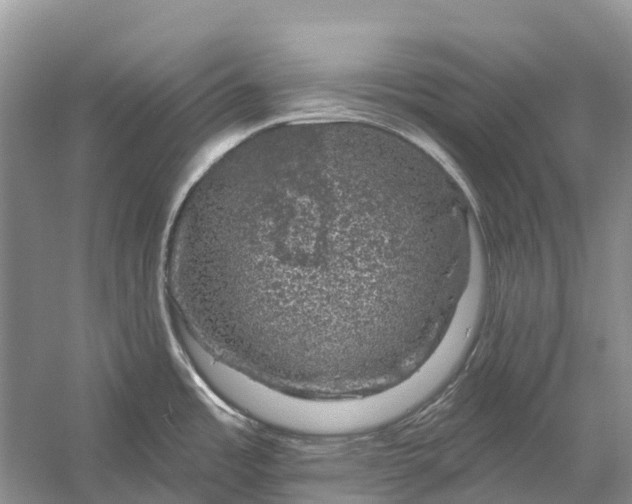 X0000058141485200510072018