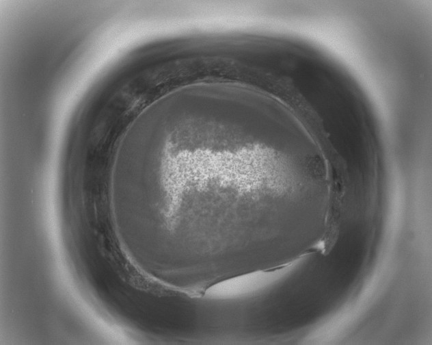 X0000058141487200510072018