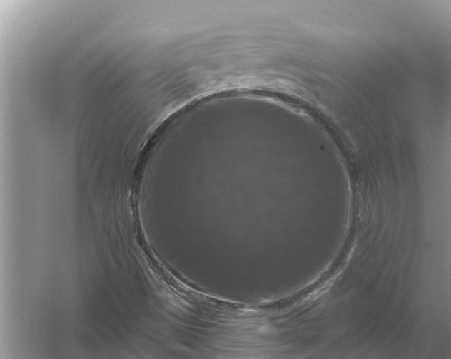 X0000058141497200510072017