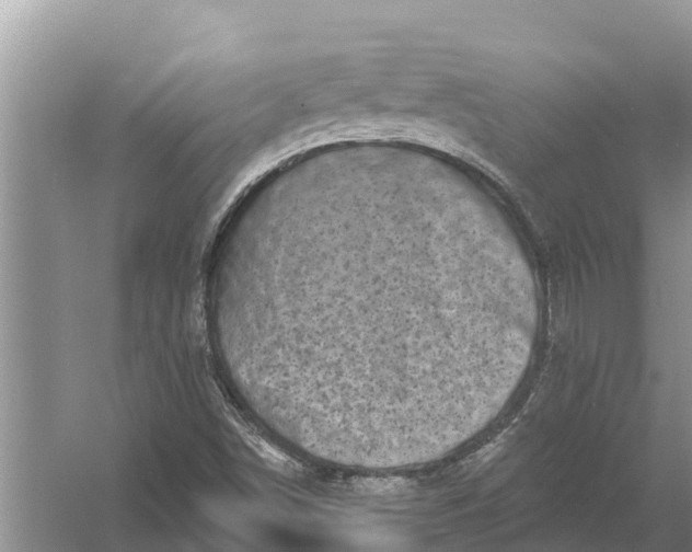 X0000058141498200510072017