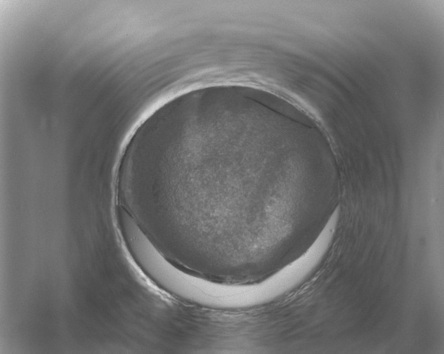 X0000058141528200510072018