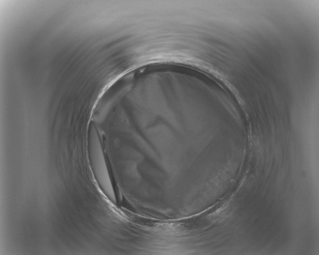 X0000058141529200510072018