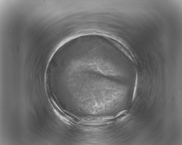 X0000058141535200510072018