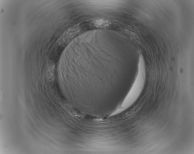 X0000058140319200510171409