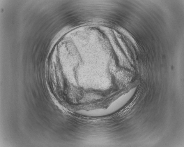 X0000058141099200510171356