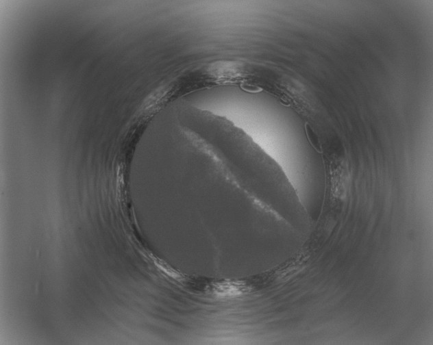 X0000058760618200509301019