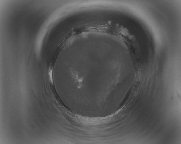 X0000058760047200510031030