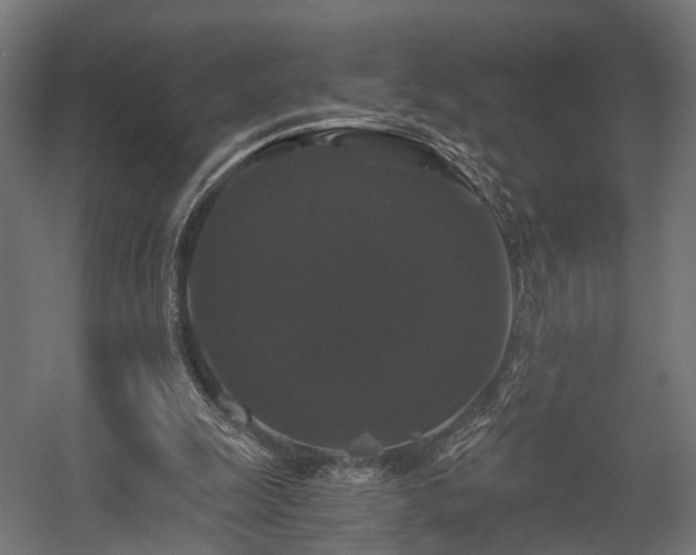 X0000058760247200510031026