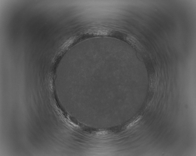X0000058760309200510031026