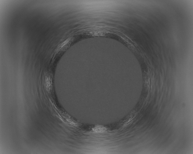 X0000058760603200510031021