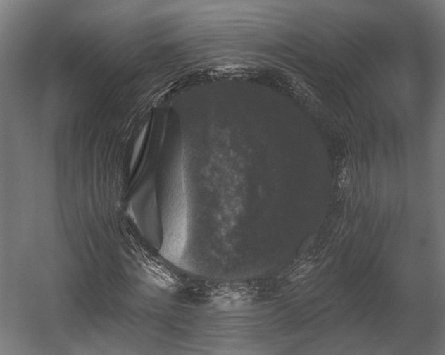 X0000058760868200510031016