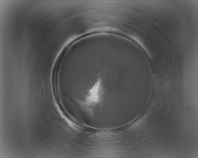 X0000058761046200510031013