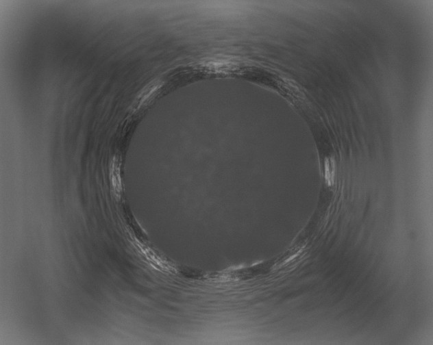 X0000058761155200510031011