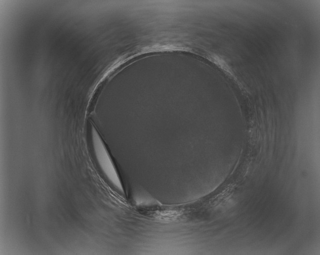 X0000058761173200510031011