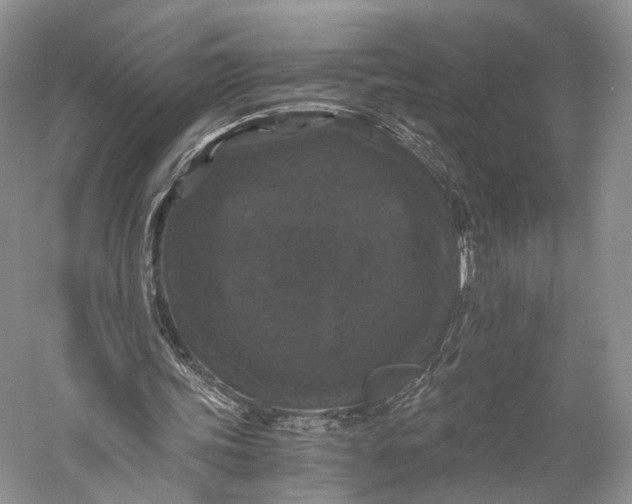 X0000058760339200510171205