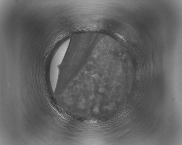 X0000058760687200510171159