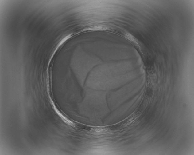 X0000058761095200510171152