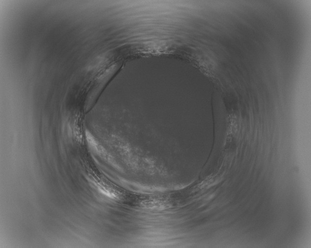 X0000058761202200510171150
